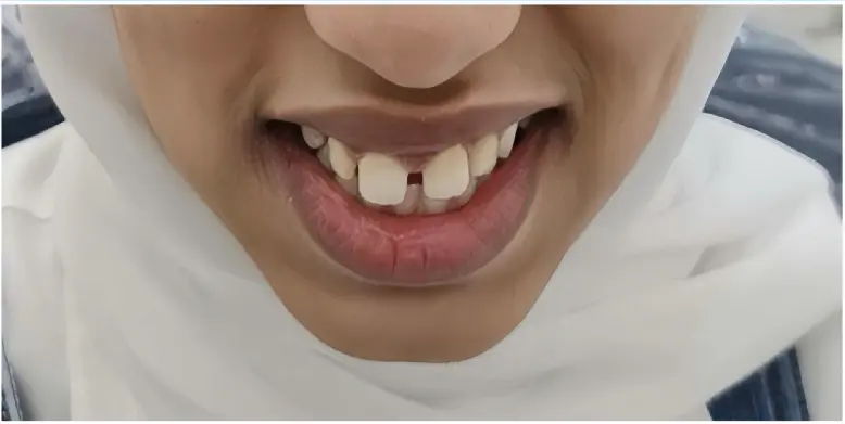 Before treatment