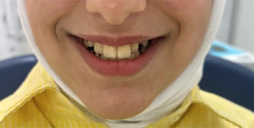 Before treatment